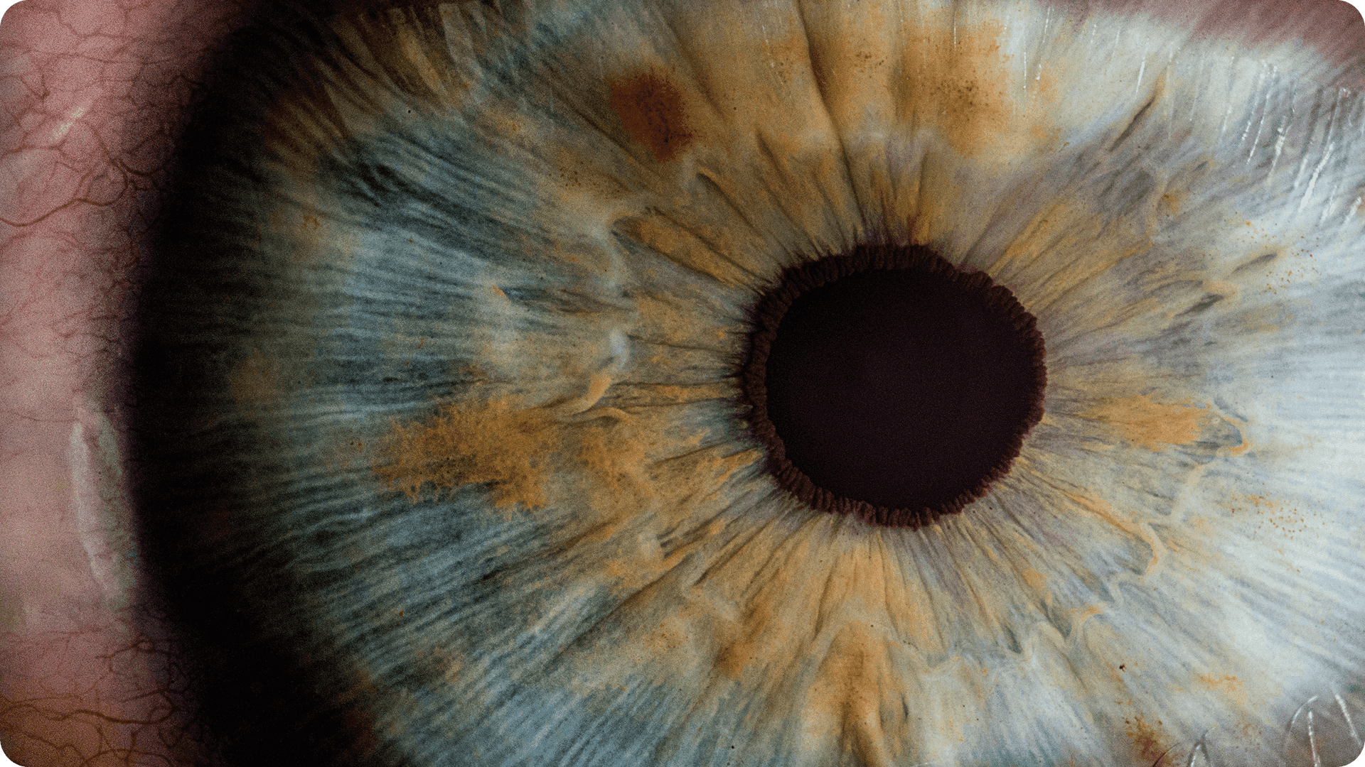 Catarata: como softwares de atendimento aumentam a adesão às cirurgias